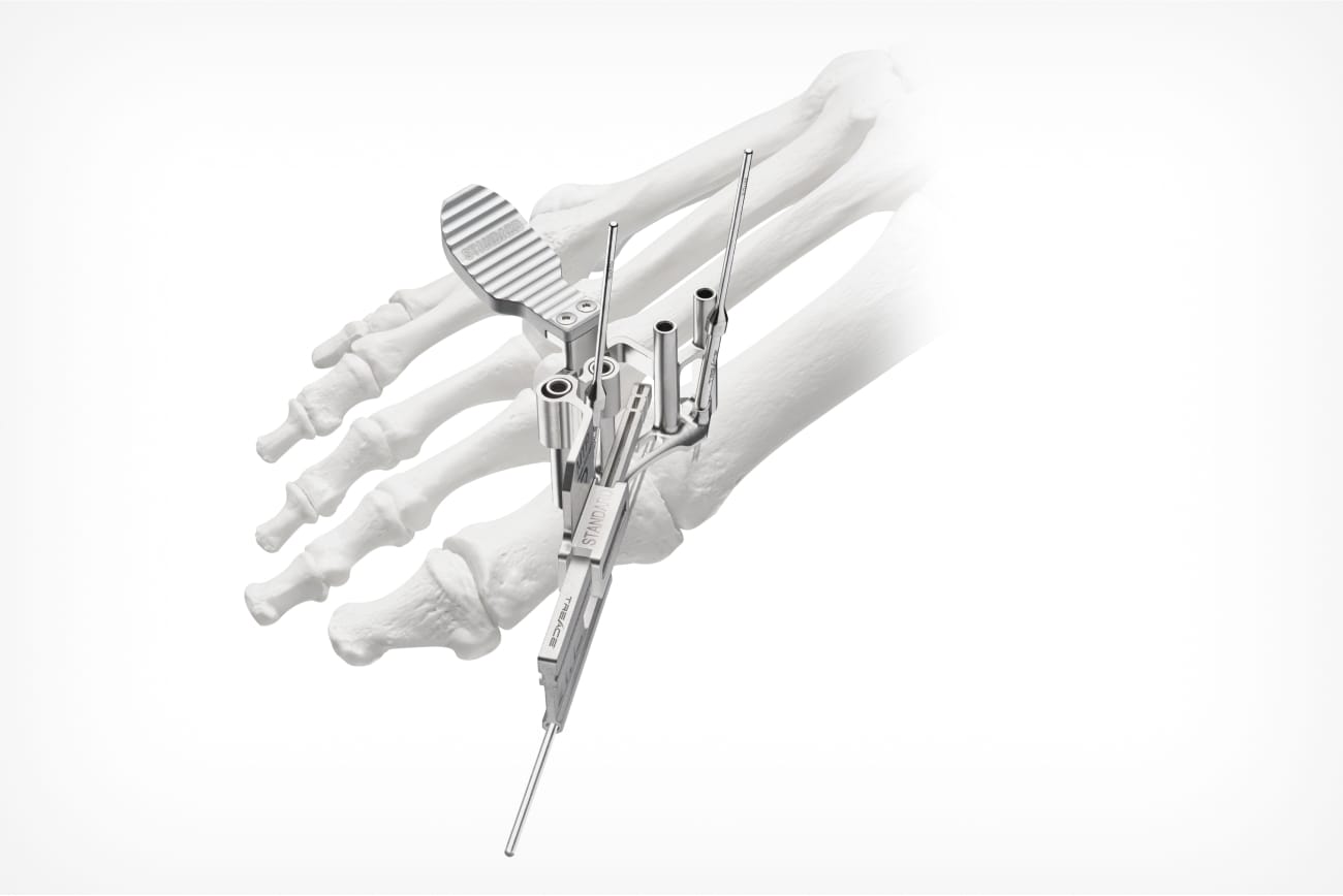 Surgical instruments aligned with a foot skeleton model, showcasing medical equipment for orthopedic procedures.