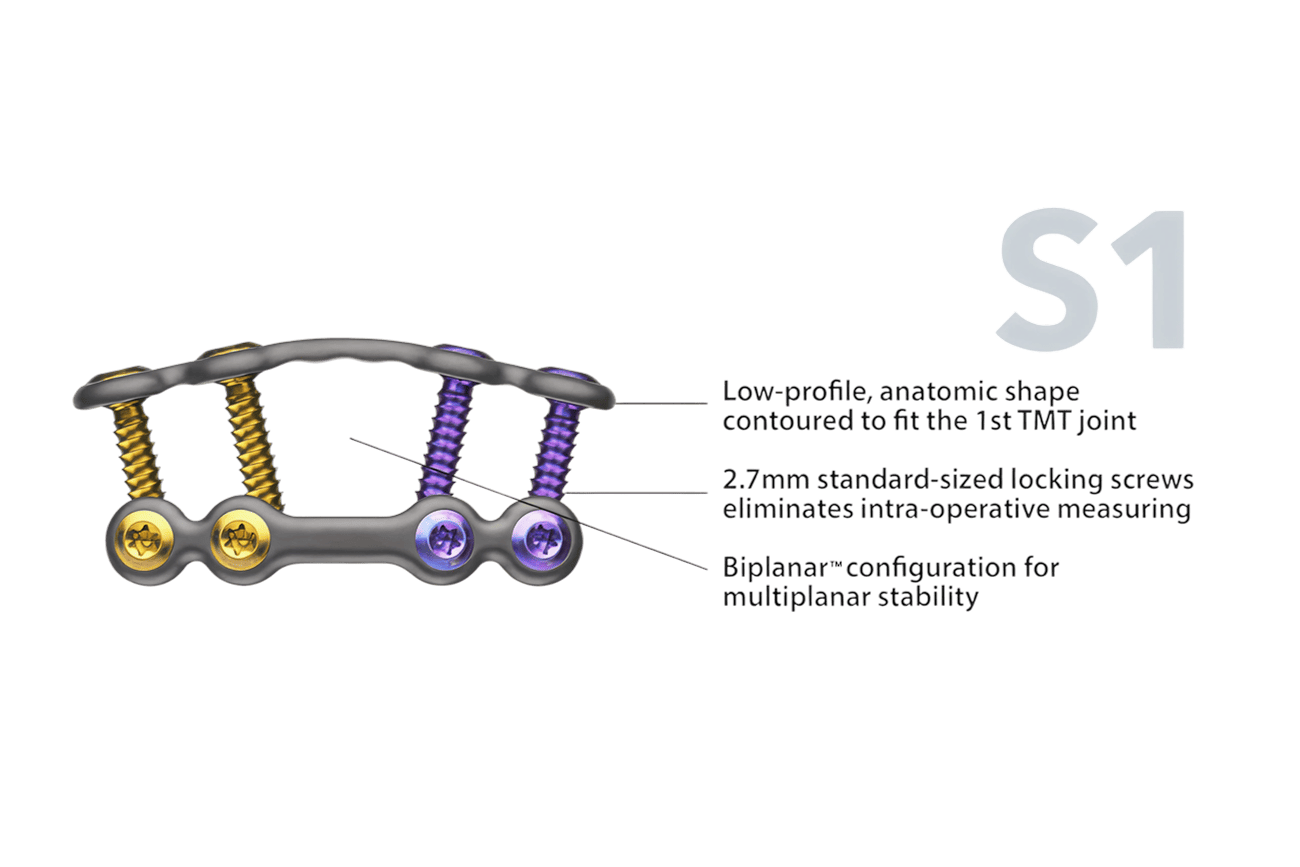 Orthopedic implant with low-profile, anatomic shape and three standard-sized locking screws for multiplanar stability.
