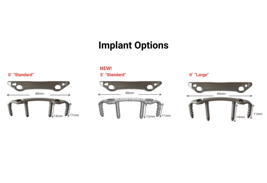 SpeedMTP® | Rapid Compression for First MTP Fusion